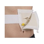 Tube Pak Enteral Feeding Tube Management System